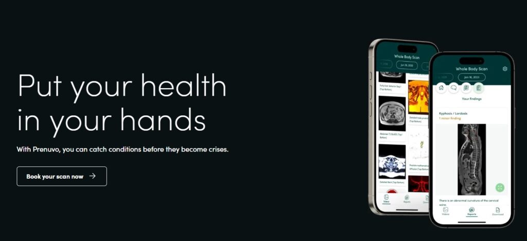Prenuvo App